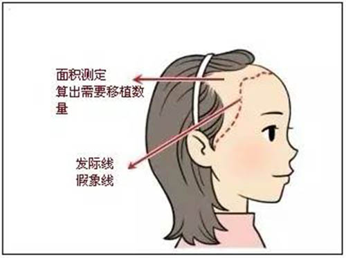口腔费用,