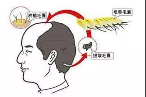 口腔,