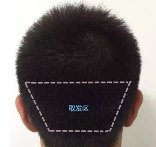 ,毛囊,