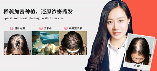 ,口腔效果,