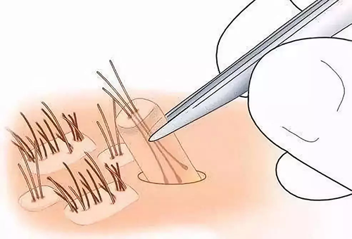,口腔,