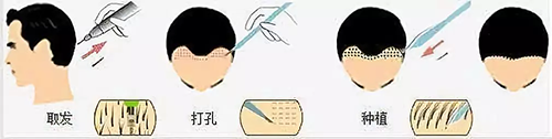 口腔,毛囊存活率,