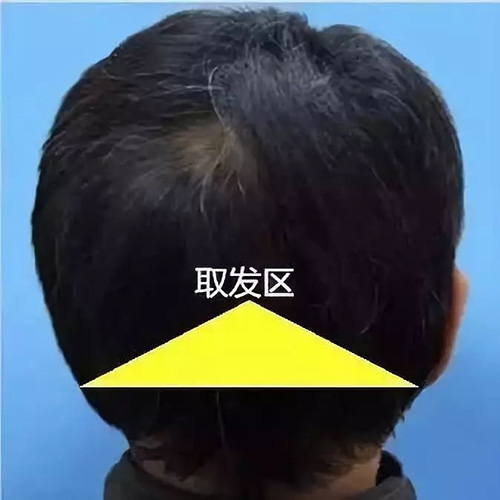 口腔,毛囊,