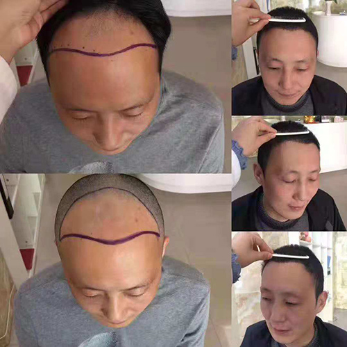 口腔,