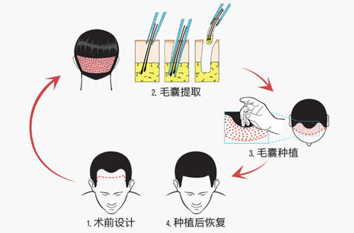 ,牙科移植医生,