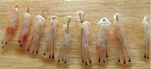 口腔,头发种植效果,