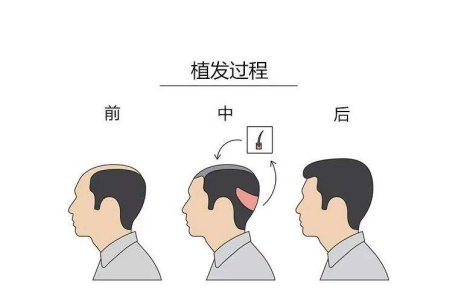 脱发,口腔,