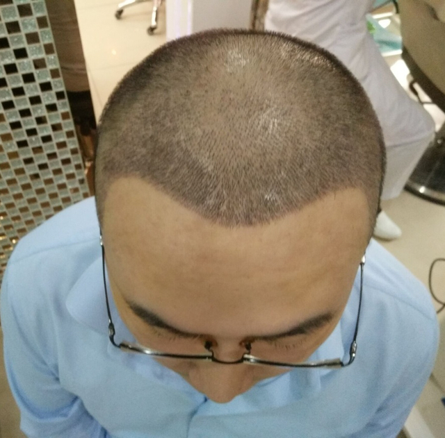 口腔后怎样护理,,