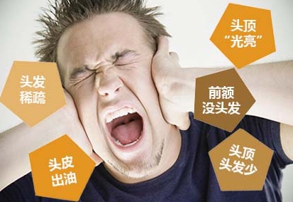 脱发,