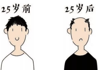 脱发,